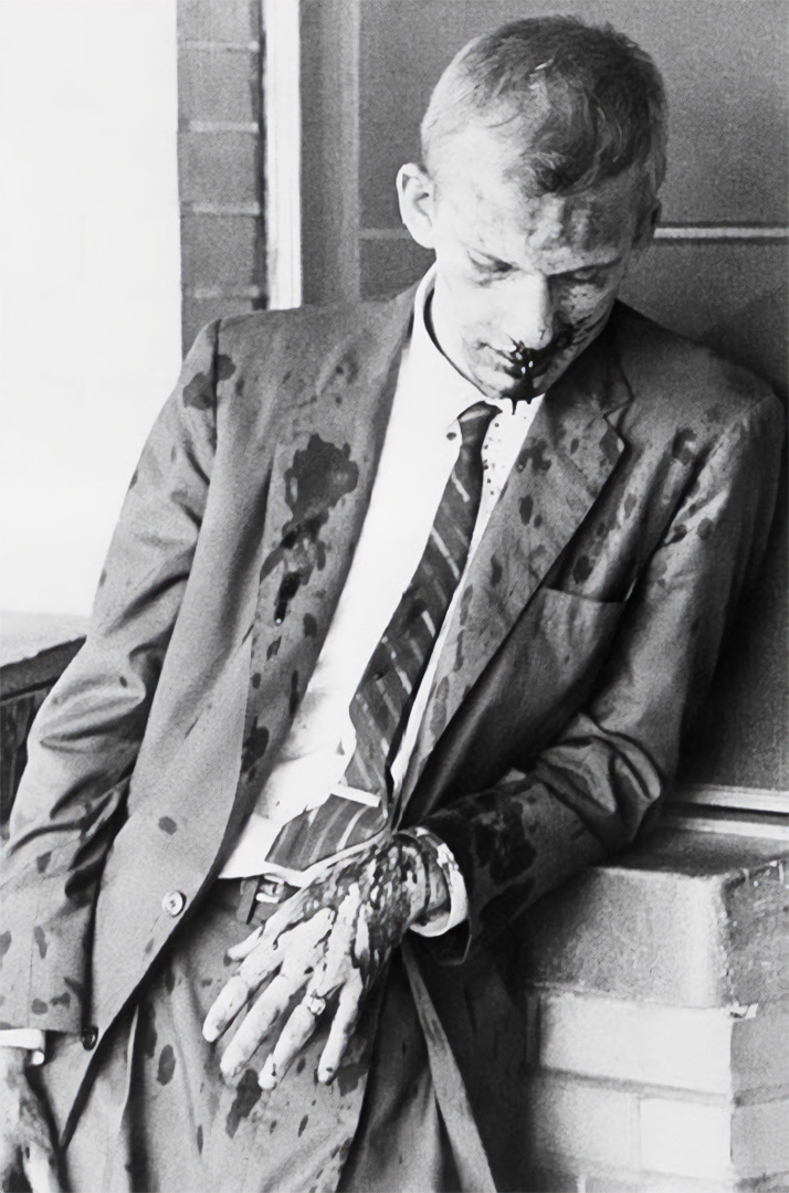Appleton resident Jim Zwerg was battered and bloodied while participating in the 1961 Freedom Rides in Montgomery, AL.